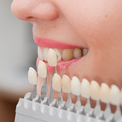 Closeup of teeth compared with tooth shade chart