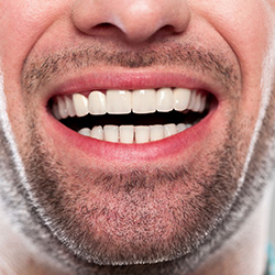 Closeup of healthy teeth and gums