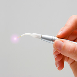 Hand holding a soft tissue laser